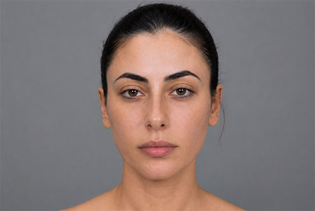 אחרי פילינג בינוני – עור אחיד ובהיר יותר